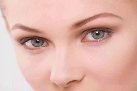 水肿、黑眼圈只是因为没睡好？女性眼部问题潜藏的病症