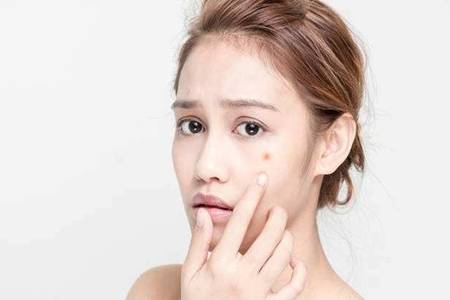 白头粉刺的形成原因是什么 脸上长白头粉刺怎么办该如何治疗