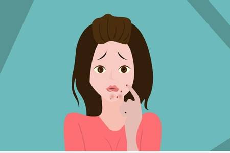 女生下巴长痘的原因，教你六个诀窍简单祛痘