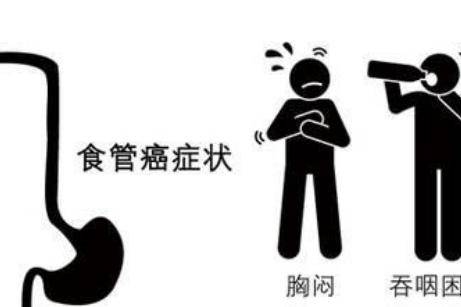 食道癌的早期症状是什么？如何预防食道癌的发生