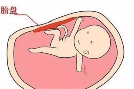 艾滋病是怎么传染上的 女性如何有效预防艾滋
