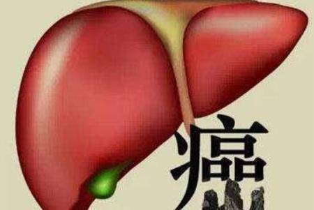 肝癌最多能活多久？预防肝癌生活中要如何健康饮食